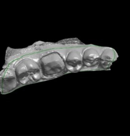 antalya diş laboratuvarı