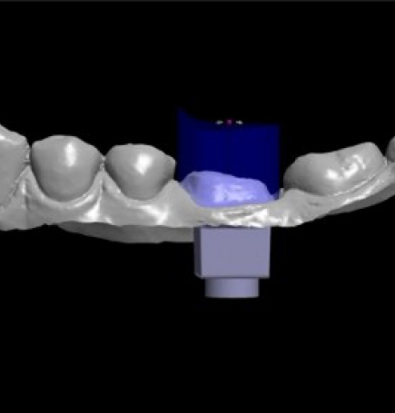 antalya diş laboratuvarı